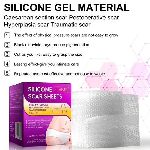 product_image_name-ELAIMEI-Silicone Scar Sheet - 1.5cm -1.5m-1